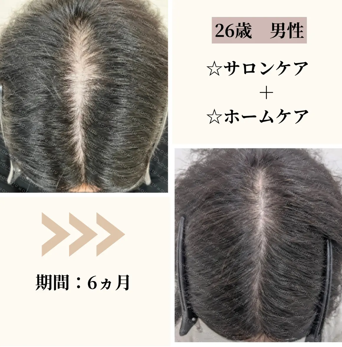 24Hカプセル技術