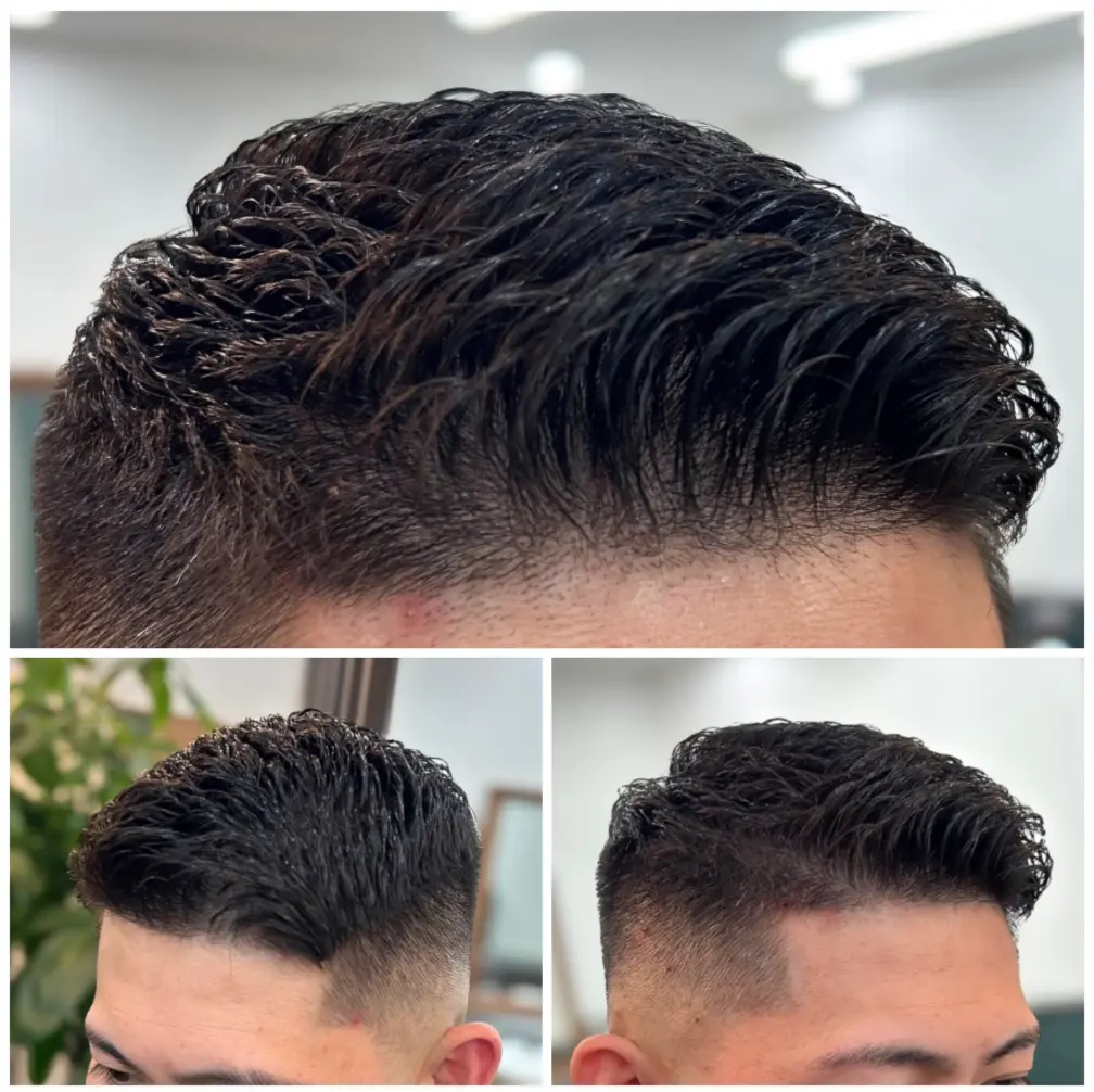 頭皮診断の様子